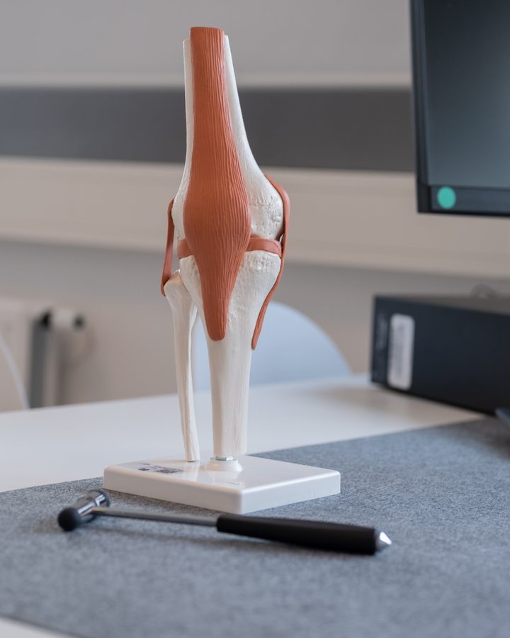 Anatomisches Kniemodell zur Erklärung der Kniearthrose-Behandlung